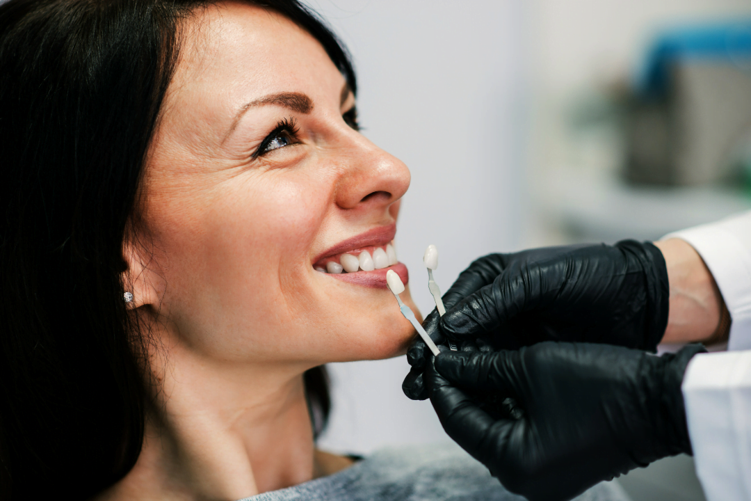 Cosmetic Dentistry NHS Dentist Welling Kent Bellegrove Dental Surgery