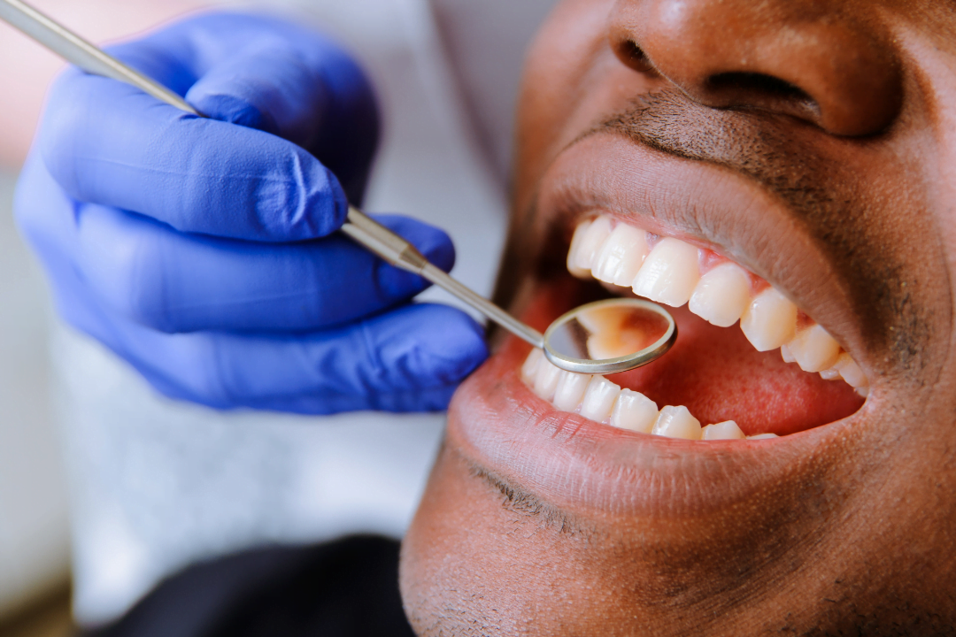 General Dentistry NHS Dentist Welling Kent Bellegrove Dental Surgery